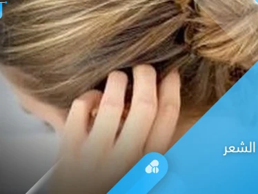 علاج أكزيما الشعر الدهنية بالأعشاب والنظام الغذائي المناسب لها