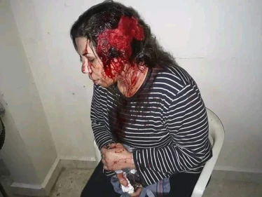 ميليشيا "قسد" تعتقل عدداً من الناشطين وتعتدي بالضرب على أحد رموز الثورة في الرقة!!