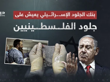 أثار الجدل في وسط حرب غـ..ـزة… ما هو بنك الجلد الإسرائيلي