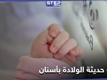 شاهد|| طفلة حديثة الولادة تملك أسناناً.. حالة طبية نادرة في مصر