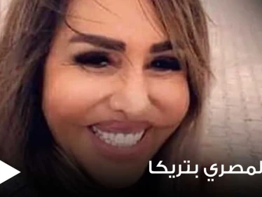 شاهد|| مها المصري تصدم الجمهور بإطلالتها الأخيرة من تركيا.. وتشوّه في ملامحها