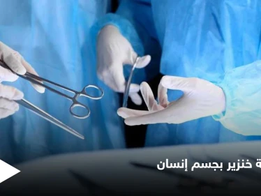 تجارة الأعضاء البشرية إلى زوال بعد نجاح زراعة كلية خنزير في جسم إنسان لأول مرة في التاريخ