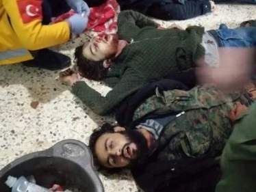 قتلى لـ الجيش الوطني في كلجبرين جرّاء هجوم للميليشيات الكردية