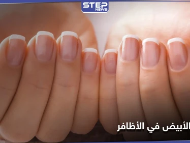 ما سر وجود القوس الأبيض في الأظافر وطريقة التعرف على صحة جسمك من خلاله