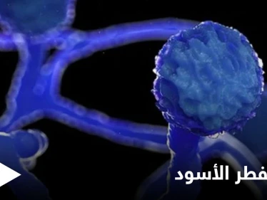 مخاوف من الفطر الأسود.. والصحة العالمية تحذر دولة عربية من وصول المتحور الهندي إليها