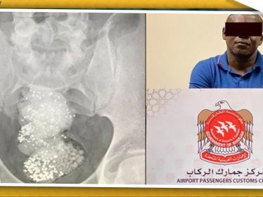 السلطات الإماراتية تلقي القبض على "مهرّب" أخفى الألماس في أحشائه