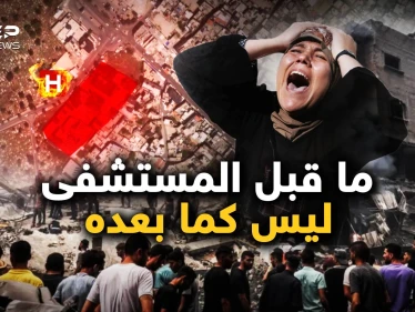 مستشفى المعمداني.. كل شيء بعد ذلك تغيّر