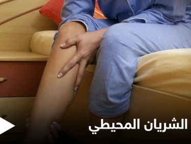 مرض الشريان المحيطي مشكلة صحية تصيب الأطراف وتتسبب بضعفها تعرف عليه
