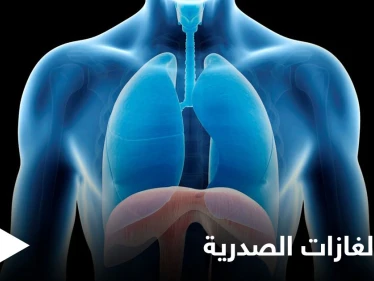 علاج الغازات الصدرية في المنزل وعلاقتها بآلام القلب إليك أهم المعلومات