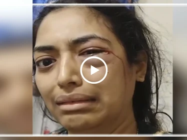 "تويتر" ينقذ هندية من تعذيب زوجها وضربه لها.. والسلطات الإماراتية تتحرك(فيديو)
