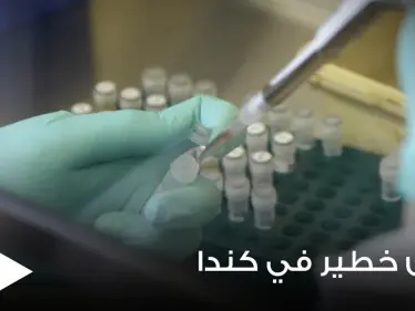 مرض مجهول ينتشر بكندا يحمل أعراضاً غريبة منها رؤية الموتى - وكالة ستيب نيوز