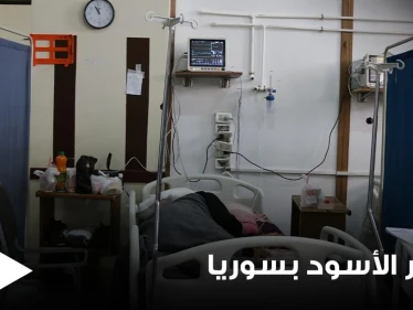 الفطر الأسود خطر جديد يلاحق السوريين وصحة دمشق تدق ناقوس الخطر.. تعرف على مخاطره وطرق علاجه