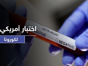 اختبار أمريكي جديد من شأنه كشف ملايين المصابين بكورونا بوقت قياسي