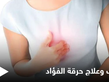 حرقة الفؤاد.. حموضة في المعدة وعسر في الهضم إليك أهم الأسباب وطرق العلاج