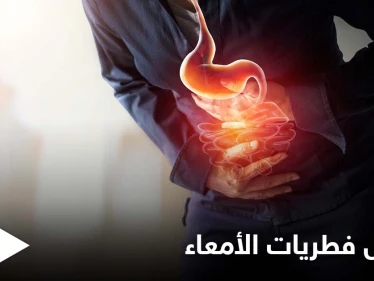 ما هي أعراض فطريات الأمعاء وخطورتها وأسباب الإصابة بها تعرف على التفاصيل