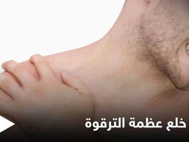 تعرف على أسباب خلع عظمة الترقوة وأعراضه وطرق العلاج