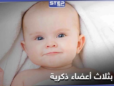 طفل عراقي بـ "3 أعضاء ذكريّة" كأول حالة مُسجلة في العالم