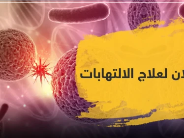 أموكلان لعلاج الالتهابات