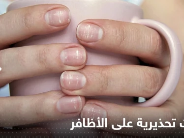 4 علامات تظهر على اليد قد تشير إلى إصابتك بـ مرض السكري لا تتجاهلها
