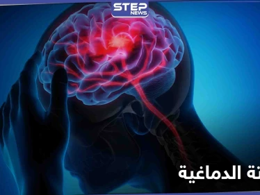 السكتة الدماغية تنهي حياة أعداد كبيرة يومياً.. أعراضها وطرق الوقاية منها