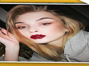 صور || "شفاه الأخطبوط" موضة جديدة في جراحة التجميل للفتيات