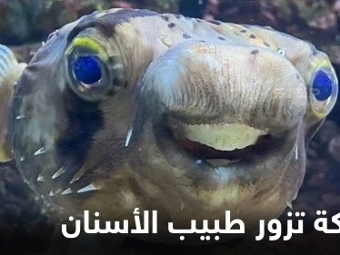 شاهد|| سمكة البخاخ تخضع لعملية برد أسنان بعد أن كبرت لدرجة حرمتها من الطعام