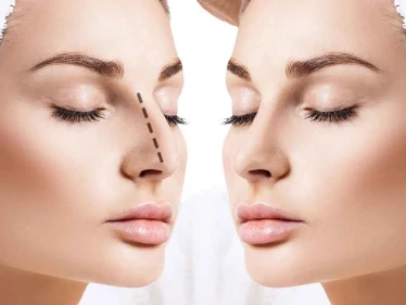 طريقة عملية تجميل الانف وخطوات إجرائها بالتفصيل.. فوائد وأضرار