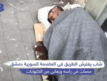شاب مصاب برأسه يفترش طرقات العاصمة السورية دمشق