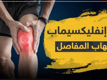 دواء إنفليكسيماب لالتهاب المفاصل