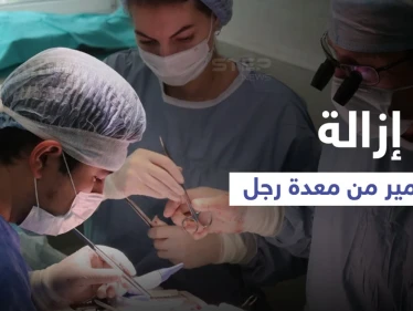 عملية جراحية معقدة لرجل ابتلع المسامير والبراغي لشهر كامل والسبب الكحول (صورة)