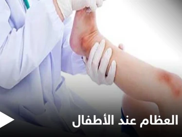 هل تصل الجراثيم إلى العظام وماهي عدوى العظام والمفاصل وخطورتها على الأطفال إليك أهم المعلومات