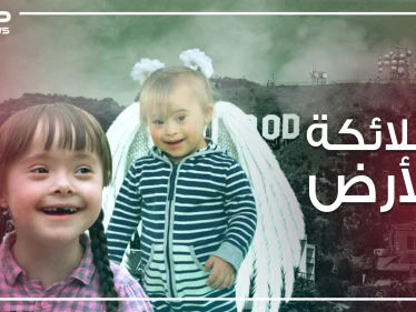 ليسوا منغوليين ..طفرة جينية نتج عنها هذا الشكل ..متلازمة داون الأسباب والتفاصيل