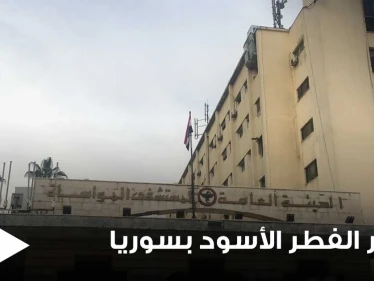 وسط ازدياد حالات الإصابة.. مدير إحدى المستشفيات السورية يكشف سبب زياة انتشار الفطر الأسود