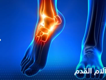 علاج آلام الأقدام من الوقوف.. تعرف على طرق منزلية بسيطة