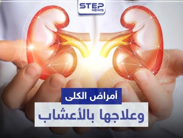أمراض الكلى الشائعة.. و 8 أعشاب طبيعية لعلاجها