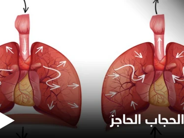 ما هي وظيفة الحجاب الحاجز وكيف يتم علاجه عن طريق العمل الجراحي إليك أهم المعلومات