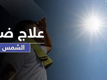 ضربة الشمس حالة خطيرة قد تودي بحياة الإنسان .. أسبابها وطرق علاجها