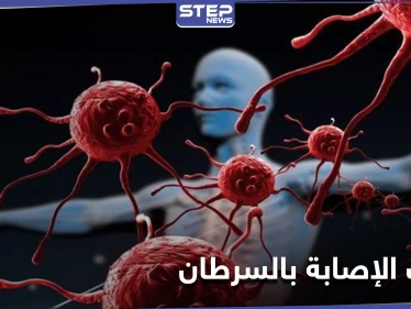 إجراءات تساعد على تجنب الإصابة بالسرطان والتعرّف عليه بمرحلة مبكرة