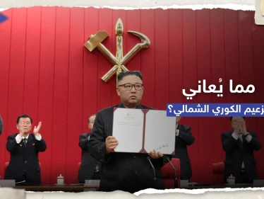 الكشف عن وزن زعيم كوريا الشمالية وسبب ظهور كدمات وخدوش على ذراعه