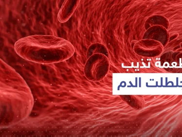 شائعة وبسيطة.. أطعمة يمكنها أن "تذيب بشكل طبيعي" جلطات الدم القاتلة