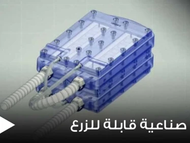 اختراع علمي مذهل.. علماء يبتكرون أول كلية صناعية قابلة للزرع قد تكون طوق النجاة