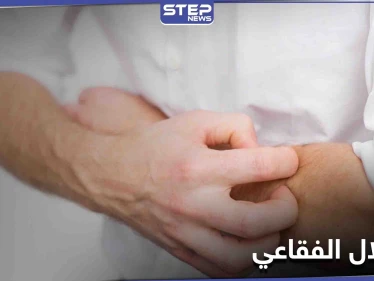 من أخطر الأمراض النادرة الانحلال الفقاعي وأعراضه الشائعة