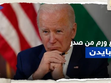 إزالة "ورم جلدي" من صدر بايدن وطبيبه يكشف 3 أمراض يعاني منها
