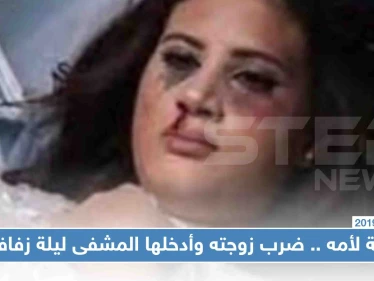 سمع كلام أمه وضرب زوجته ليلة زفافهما فأدخلها إلى العناية المركزة