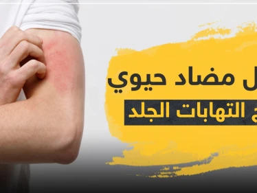 8 أسماء ... أفضل مضاد حيوي لعلاج التهابات الجلد