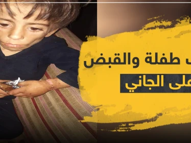 بالصور|| طفلة تتعرض لأبشع أنواع التعذيب على يد والدها والمعارضة السورية تقبض عليه