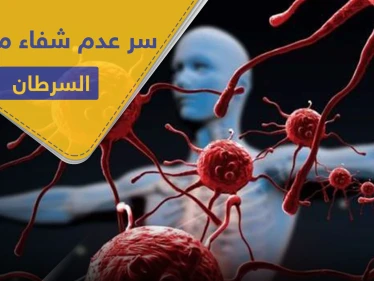 بحث أمريكي حديث.. يكشف خفايا مرض السرطان وسبب عدم امتثال المرضى للشفاء