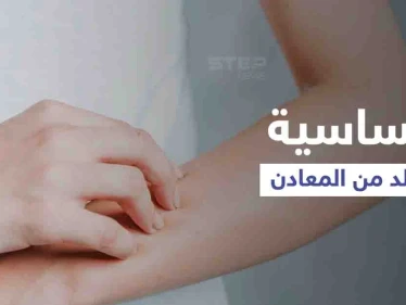 ما هي حساسية الجلد من المعادن وأهم أعراضها وطرق العلاج
