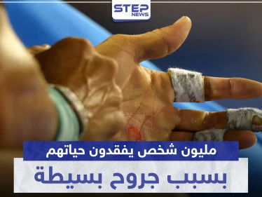 مليون شخص يفقدون حياتهم سنوياً بسبب جروح لا نعطيها أهمية.. تعرف ماذا تقول الدراسات