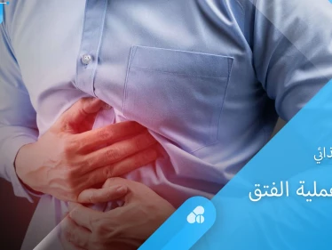 تعرف على النظام الغذائي الواجب اتباعه بعد إجراء عملية الفتق